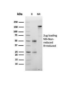 SDS-PAGE analysis of Anti-Albumin Antibody [ALB/6413R] under non-reduced and reduced conditions; showing intact IgG and intact heavy and light chains, respectively. SDS-PAGE analysis confirms the integrity and purity of the antibody