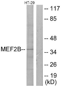 Anti-MEF2B Rabbit Polyclonal Antibody