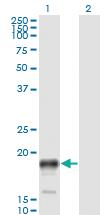 Anti-PSCA Mouse Monoclonal Antibody [clone: 1E1]