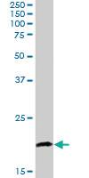 Anti-CABP1 Goat Polyclonal Antibody