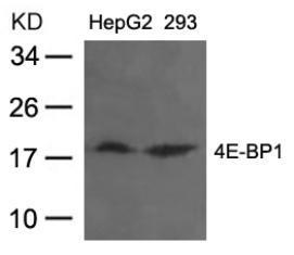 Western blot analysis of lysed extracts from HepG2 and 293 cells using 4E-BP1 (Ab-36).