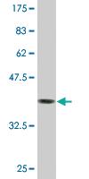 Anti-SAA4 Mouse Monoclonal Antibody [clone: 3C11]