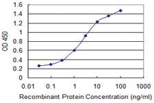 Anti-PSCA Mouse Monoclonal Antibody [clone: 1E1]