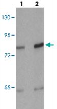 Anti-FLT3 Rabbit Polyclonal Antibody