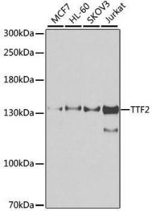 Western blot analysis of extracts of various cell lines, using Anti-TTF2 Antibody (A10216) at 1:1,000 dilution. The secondary antibody was Goat Anti-Rabbit IgG H&L Antibody (HRP) at 1:10,000 dilution.