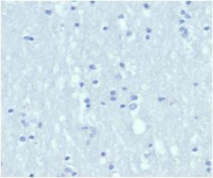 Negative Tissue Control: Immunohistochemical analysis of formalin-fixed, paraffin-embedded human brain using Anti-Cytokeratin 6A Antibody [KRT6/3997R] at 2 µg/ml in PBS for 30  minutes at room temperature