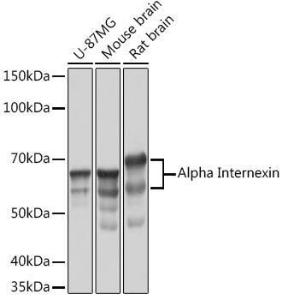 Western blot analysis of extracts of various cell lines, using Anti-alpha Internexin Antibody [ARC2054] (A305822) at 1:1,000 dilution. The secondary antibody was Goat Anti-Rabbit IgG H&L Antibody (HRP) at 1:10,000 dilution.