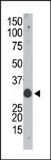 Anti-APOBEC1 Rabbit Polyclonal Antibody