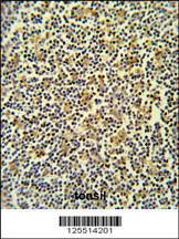 Anti-CORO6 Rabbit Polyclonal Antibody