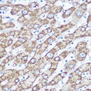 Immunohistochemistry analysis of paraffin-embedded human liver using Anti-NDUFA4 Antibody (A307518) at a dilution of 1:100 (40x lens). Perform high pressure antigen retrieval with 10 mM citrate buffer pH 6.0 before commencing with IHC staining protocol.