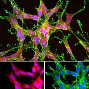 Antibody anti-DJ1 100 µl