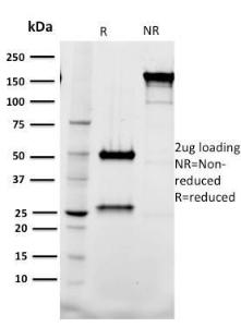 SDS-PAGE analysis of Anti-Tal1 Antibody [BTL73] under non-reduced and reduced conditions; showing intact IgG and intact heavy and light chains, respectively. SDS-PAGE analysis confirms the integrity and purity of the antibody