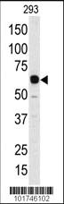 Anti-APOBEC1 Rabbit Polyclonal Antibody