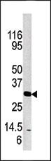 Anti-Prostate Specific Antigen (KLK3) Rabbit Polyclonal Antibody