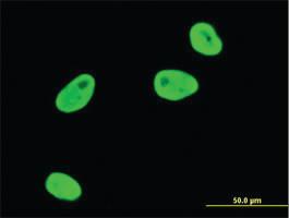 Anti-SGK1 Mouse Monoclonal Antibody [clone: 3C4]