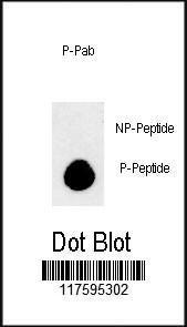 Anti-MAP1LC3B Rabbit Polyclonal Antibody (PE (Phycoerythrin))