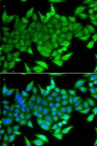 Immunofluorescence analysis of A549 cells using Anti-TTF2 Antibody (A10216). DAPI was used to stain the cell nuclei (blue).