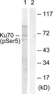 Western blot analysis of lysates from HeLa cells using Anti-Ku70 (phospho Ser5) Antibody. The right hand lane represents a negative control, where the antibody is blocked by the immunising peptide