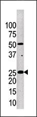 Anti-KLK4 Rabbit Polyclonal Antibody