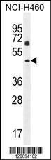 Anti-CL029 Rabbit Polyclonal Antibody (Biotin)