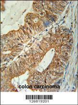 Anti-TSPAN3 Rabbit Polyclonal Antibody (HRP (Horseradish Peroxidase))