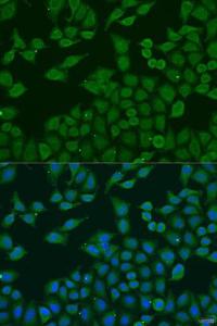 Anti-PLA2G4C antibody