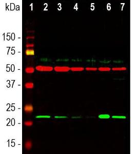 Antibody anti-DJ1 100 µl