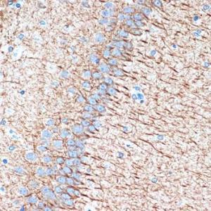 Immunohistochemistry analysis of paraffin-embedded rat brain using Anti-alpha Internexin Antibody [ARC2054] (A305822) at a dilution of 1:100 (40x lens). Perform microwave antigen retrieval with 10 mM Tris/EDTA buffer pH 9.0 before commencing with IHC staining protocol.