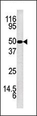 Anti-KLK5 Rabbit Polyclonal Antibody