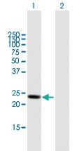 Anti-LYPLA1 Mouse Polyclonal Antibody