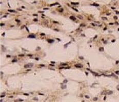 Anti-IL1B Mouse Monoclonal Antibody [clone: 2H12]