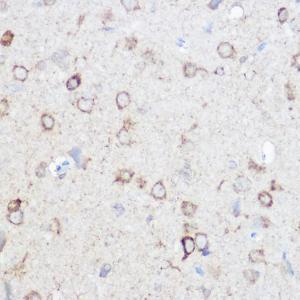 Immunohistochemistry analysis of paraffin-embedded mouse brain using Anti-NDUFA4 Antibody (A307518) at a dilution of 1:100 (40x lens). Perform high pressure antigen retrieval with 10 mM citrate buffer pH 6.0 before commencing with IHC staining protocol.