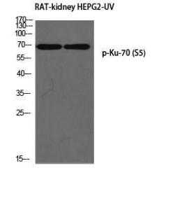 Western blot analysis of rat kidney HEPG2 UV using Anti-Ku70 (phospho Ser5) Antibody