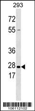 Anti-KLK5 Rabbit Polyclonal Antibody