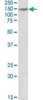 Anti-LMTK2 Goat Polyclonal Antibody