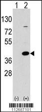 Anti-EPM2A Rabbit Polyclonal Antibody (Biotin)