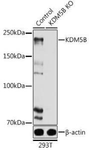 Western blot analysis of extracts from normal (control) and KDM5B knockout (KO) 293T cells, using Anti-KDM5B / PLU1 / Jarid1B Antibody (A10219) at 1:1,000 dilution. The secondary antibody was Goat Anti-Rabbit IgG H&L Antibody (HRP) at 1:10,000 dilution.