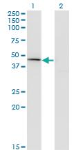 Anti-CPA1 Mouse Monoclonal Antibody [clone: 3F11]