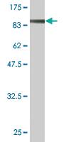 Anti-STIM1 Mouse Monoclonal Antibody [clone: 1B12]