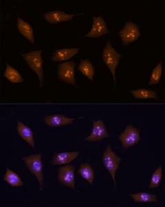 Immunofluorescence analysis of L929 using Anti-KDM5B / PLU1 / Jarid1B Antibody (A10219) at a dilution of 1:100 (40x lens). DAPI was used to stain the cell nuclei (blue).