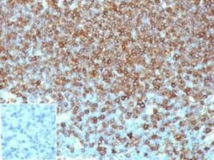 Immunohistochemical analysis of formalin-fixed, paraffin-embedded human lymph node tissue using Anti-HLA DP + DQ + DR Antibody [HLA-Pan/6663]. Inset: PBS instead of the primary antibody. Secondary antibody negative control.