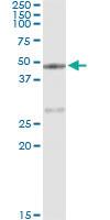 Anti-CPA1 Mouse Monoclonal Antibody [clone: 3F11]