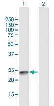 Anti-SSX4B Mouse Polyclonal Antibody