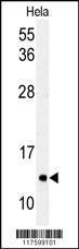 Anti-MAP1LC3C Rabbit Polyclonal Antibody (AP (Alkaline Phosphatase))