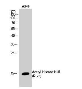 Western blot analysis of A549 cells using Anti-H2B (acetyl Lys126) Antibody