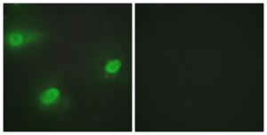 Immunofluorescence analysis of HeLa cells using Anti-CSTF2 Antibody. The right hand panel represents a negative control, where the antibody was pre-incubated with the immunising peptide