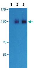 Anti-GABBR2 Rabbit Polyclonal Antibody