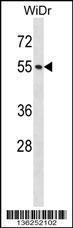 Anti-NUP50 Rabbit Polyclonal Antibody (APC (Allophycocyanin))