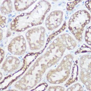 Immunohistochemistry analysis of paraffin-embedded rat kidney using Anti-NDUFA4 Antibody (A307518) at a dilution of 1:100 (40x lens). Perform high pressure antigen retrieval with 10 mM citrate buffer pH 6.0 before commencing with IHC staining protocol.