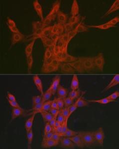 Anti-DAB2IP antibody